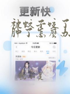 被蚊子咬了眼睛肿了怎么办