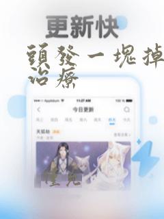 头发一块掉怎么治疗