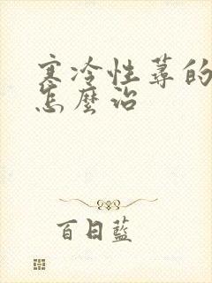 寒冷性荨的麻疹怎么治