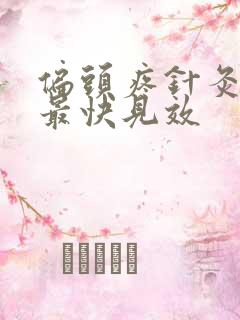 偏头疼针灸哪里最快见效