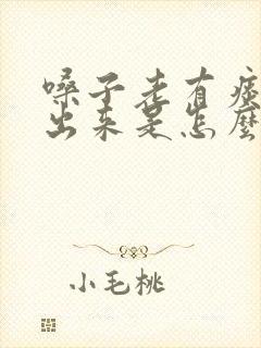嗓子老有痰咳不出来是怎么回事 嗓子老有痰咳不出来是怎么回事