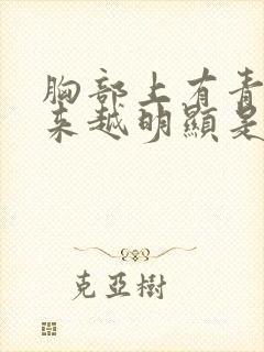 胸部上有青筋越来越明显是什么原因
