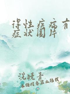 得性疾病有哪些症状图片 得性疾病有哪些症状图片