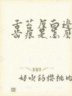 舌苔厚白边缘有齿痕是怎么回事