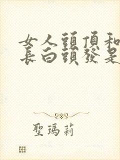 女人头顶和两鬓长白头发是什么原因