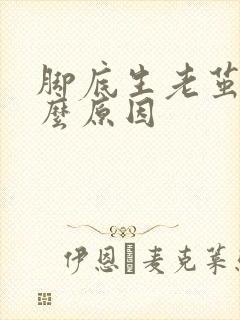 脚底生老茧是什么原因 脚底生老茧是什么原因