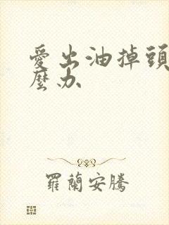 爱出油掉头发怎么办