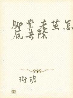 脚掌老茧怎么彻底去除
