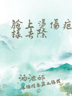 脸上烫伤疤痕怎样去除 脸上烫伤疤痕怎样去除