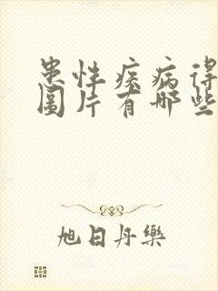 患性疾病得症状图片有哪些 患性疾病得症状图片有哪些