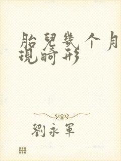 胎儿几个月能发现畸形