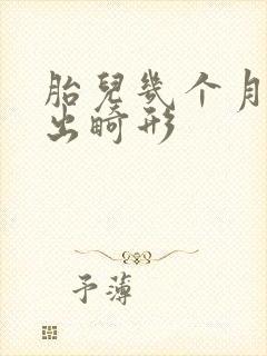 胎儿几个月能查出畸形