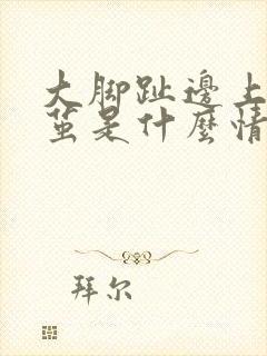 大脚趾边上长老茧是什么情况