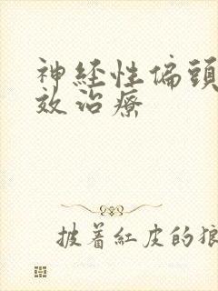 神经性偏头痛有效治疗