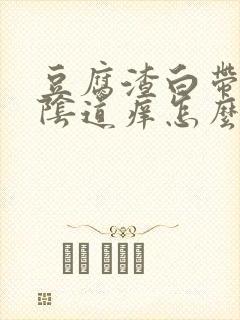 豆腐渣白带很多阴道痒怎么回事