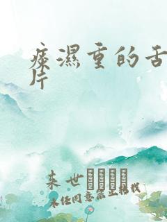 痰湿重的舌苔图片