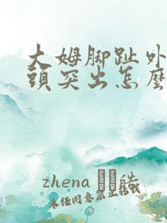 大姆脚趾外侧骨头突出怎么办