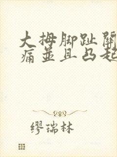 大拇脚趾关节疼痛并且凸起