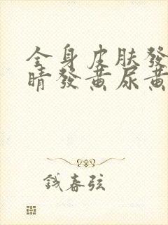 全身皮肤发黄眼睛发黄尿黄