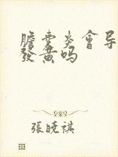 胆囊炎会导致手发黄吗