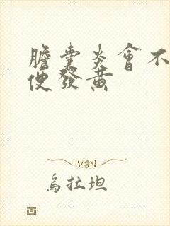 胆囊炎会不会小便发黄