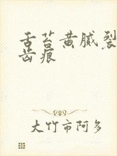 舌苔黄腻裂纹有齿痕
