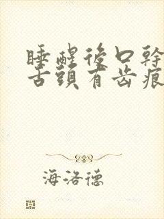 睡醒后口干口苦舌头有齿痕
