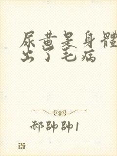 尿黄是身体哪里出了毛病