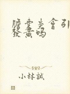 胆囊炎会引起脸发黄吗