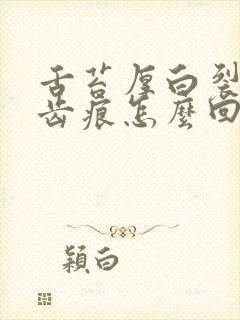 舌苔厚白裂纹有齿痕怎么回事