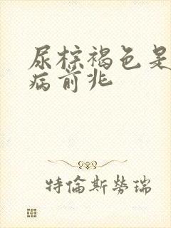 尿棕褐色是什么病前兆 尿棕褐色是什么病前兆
