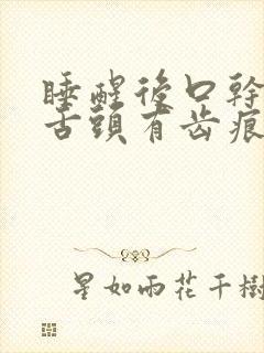 睡醒后口干口苦舌头有齿痕