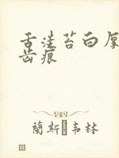 舌淡苔白厚腻有齿痕