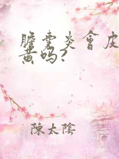 胆囊炎会皮肤发黄吗?