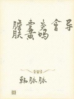 胆囊炎会导致皮肤黄吗