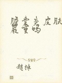 胆囊炎皮肤发黄严重吗