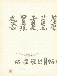 感冒舌苔厚白有齿痕是怎么回事