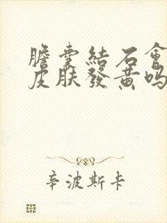 胆囊结石会导致皮肤发黄吗