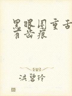 黑眼圈重舌苔白有齿痕