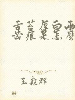 舌苔厚白两侧有齿痕是怎么回事