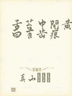 舌苔中间黄两边白有齿痕