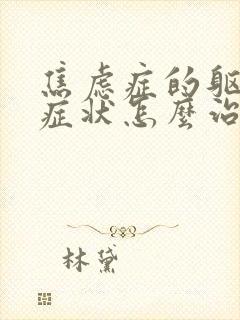 焦虑症的躯体化症状怎么治最好