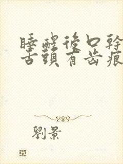 睡醒后口干口苦舌头有齿痕