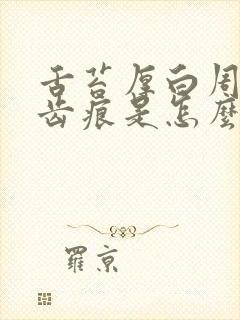 舌苔厚白周围有齿痕是怎么回事