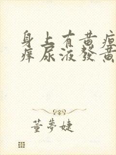 身上有黄疸还瘙痒尿液发黄怎么回事