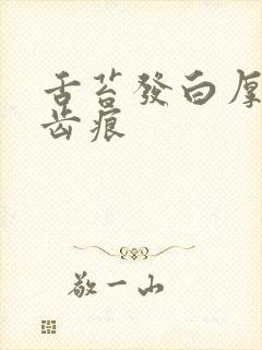 舌苔发白厚腻有齿痕