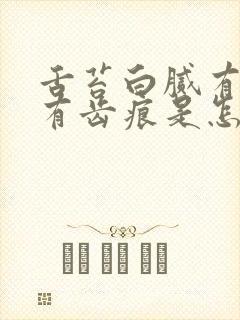 舌苔白腻有裂纹有齿痕是怎么回事