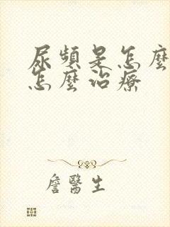 尿频是怎么回事怎么治疗