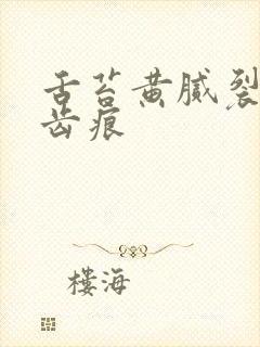 舌苔黄腻裂纹有齿痕