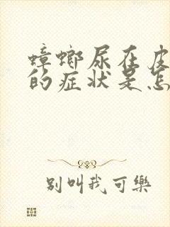 蟑螂尿在皮肤上的症状是怎样的